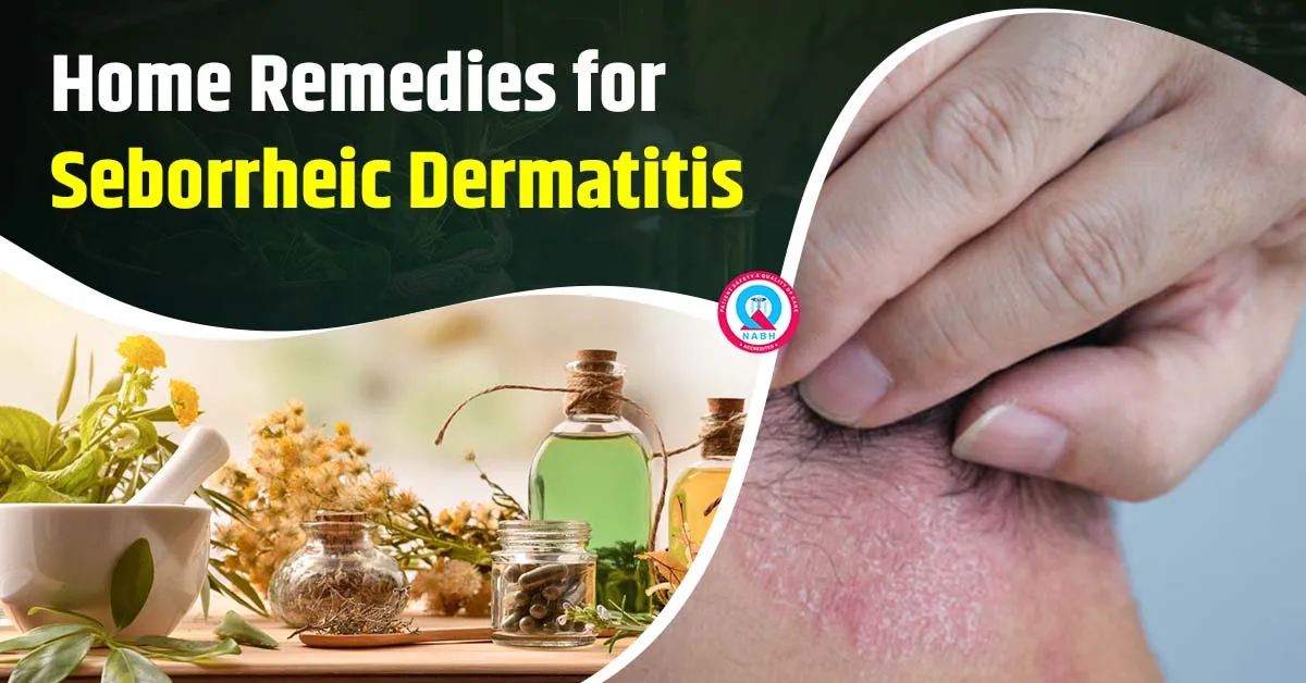 Home Remedies for Seborrheic Dermatitis